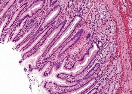 【动物实验】-科学家人体细胞植入老鼠体内培育人类肠道