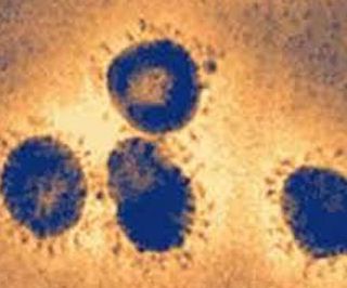 MERS冠状病毒疫苗动物实验成功