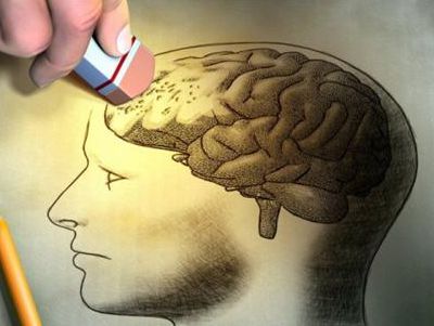 新型的阿尔茨海默病小鼠模型