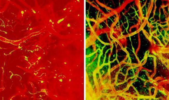 【动物造模】-在治疗小鼠脑部肿胀时时机至关重要