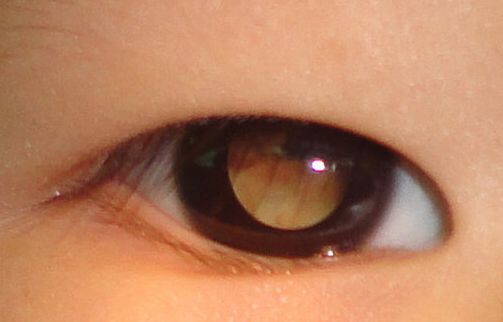 【动物造模】-如何制备斑马鱼眼瘤模型？