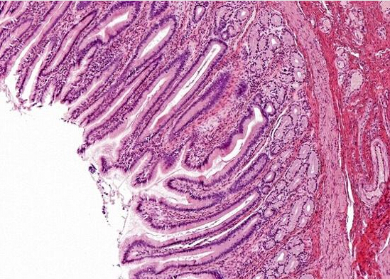 【动物造模】-科学家人体细胞植入老鼠体内培育人类肠道