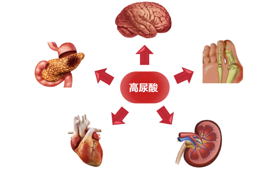 【动物造模】-大鼠高尿酸血症模型的建立与研究